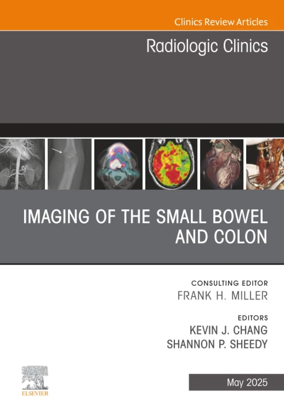 Imaging of the Small Bowel and Colon, An Issue of Radiologic Clinics of North America: Volume 63-3 (The Clinics: Radiology, Volume 63-3)