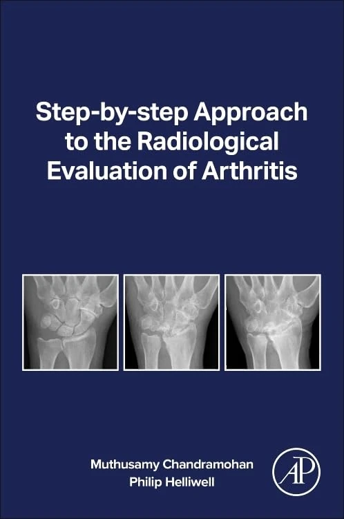 Step-by-step Approach to the Radiological Evaluation of Arthritis
