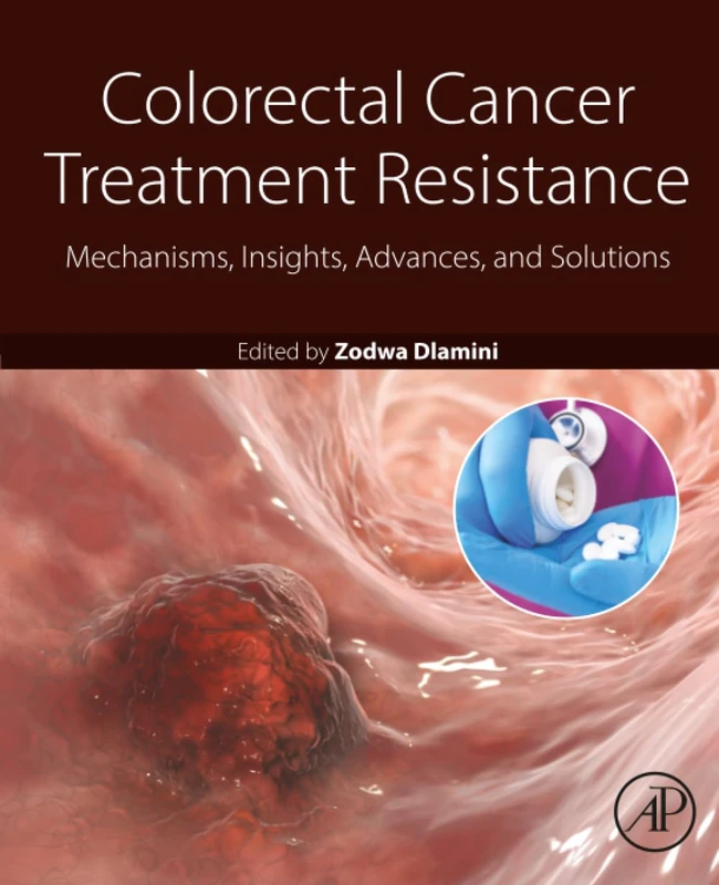 Colorectal Cancer Treatment Resistance - Academic Press Book