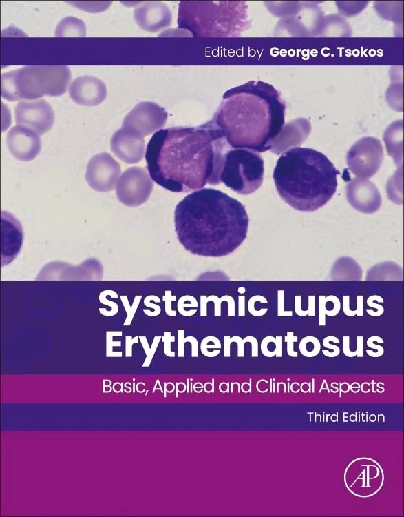 Systemic Lupus Erythematosus: Basic, Applied and Clinical Aspects