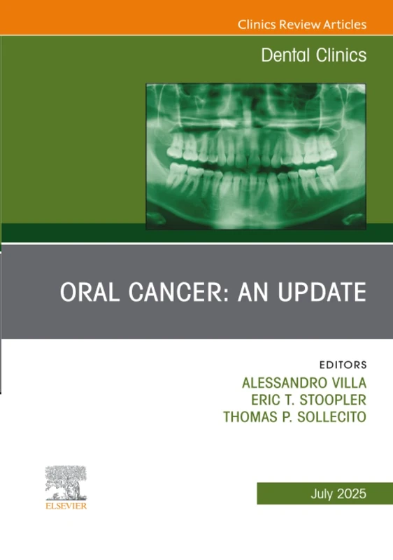 Oral Cancer: An Update, An Issue of Dental Clinics of North America: Volume 69-3 (The Clinics: Dentistry, Volume 69-3)