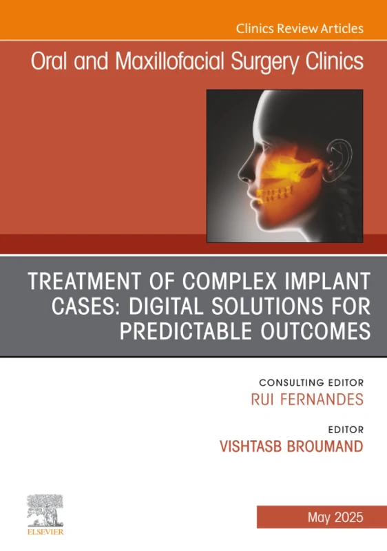 Treatment of Complex Implant Cases: Digital Solutions for Predictable Outcomes, An Issue of Oral and Maxillofacial Surgery Clinics of North America: Volume 37-2 (The Clinics: Dentistry, Volume 37-2)
