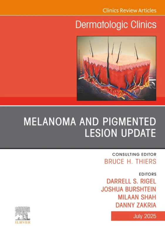 Melanoma and Pigmented Lesion Update, An Issue of Dermatologic Clinics: Volume 43-3 (The Clinics: Dermatology, Volume 43-3)