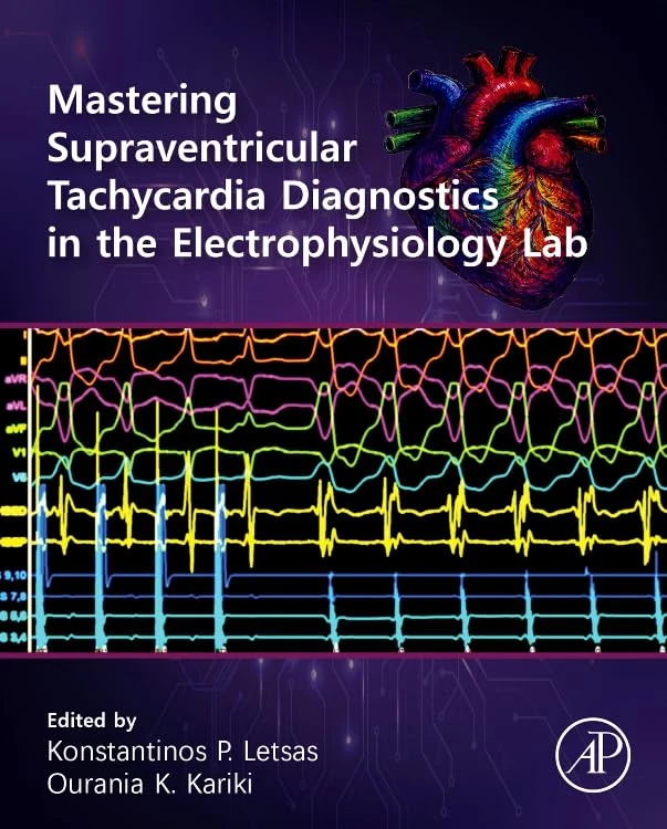 Mastering Supraventricular Tachycardia Diagnostics in the Electrophysiology Lab