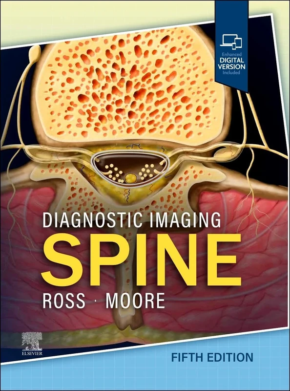 Diagnostic Imaging: Spine