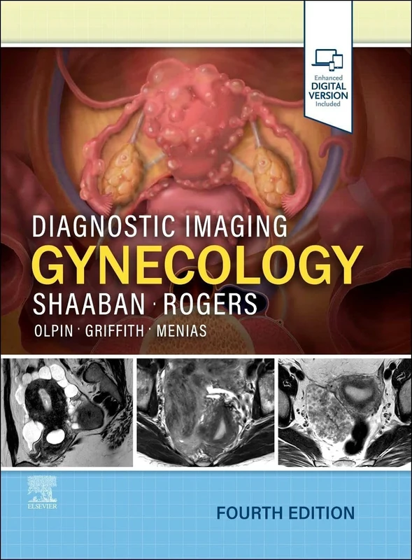 Diagnostic Imaging: Gynecology