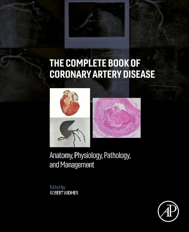 The Complete Book of Coronary Artery Disease: Anatomy, Physiology, Pathology, and Management