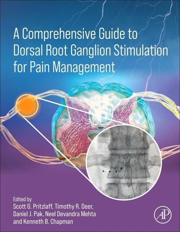 A Comprehensive Guide to Dorsal Root Ganglion Stimulation for Pain Management