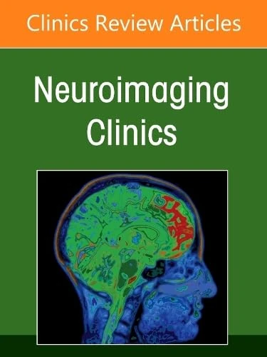 Clinical Imaging of the Spinal Cord: An Update, An Issue of Neuroimaging Clinics of North America (Volume 36-4) (The Clinics: Radiology, Volume 36-4)