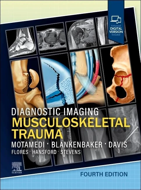 Diagnostic Imaging: Musculoskeletal Trauma