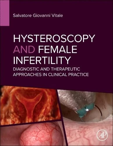 Hysteroscopy and Female Infertility: Diagnostic and Therapeutic Approaches in Clinical Practice