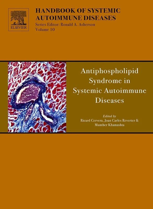 Antiphospholipid Syndrome in Systemic Autoimmune Diseases: Volume 12