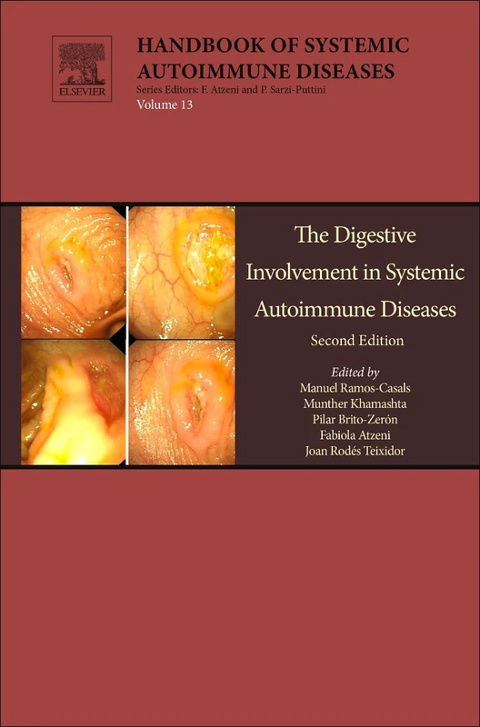 The Digestive Involvement in Systemic Autoimmune Diseases (Handbook of Systemic Autoimmune Diseases): Volume 13 - Image 1