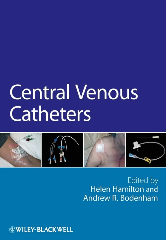 Central Venous Catheters - Image 1