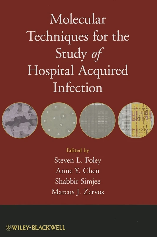 Molecular Techniques for the Study of Hospital Acquired Infection