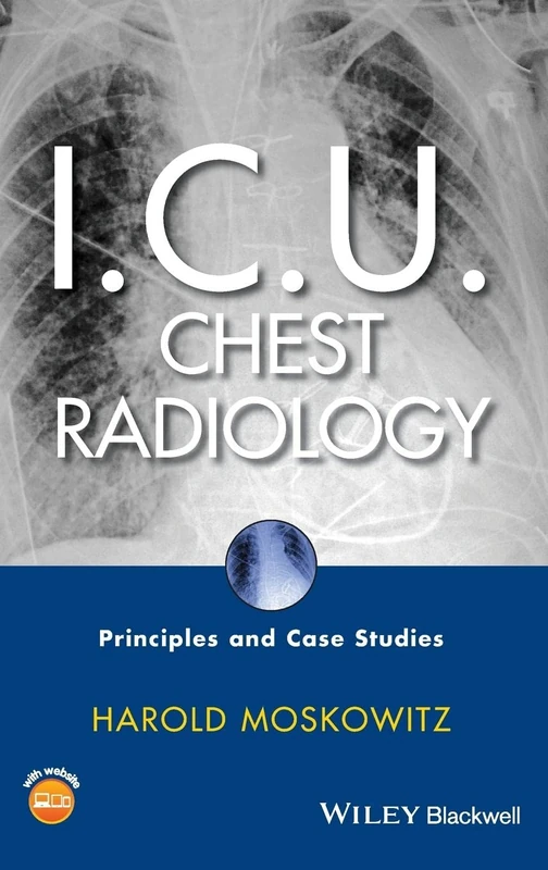 I.C.U. Chest Radiology: Principles and Case Studies