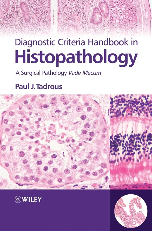 Diagnostic Criteria Handbook in Histopathology: A Surgical Pathology Vade Mecum