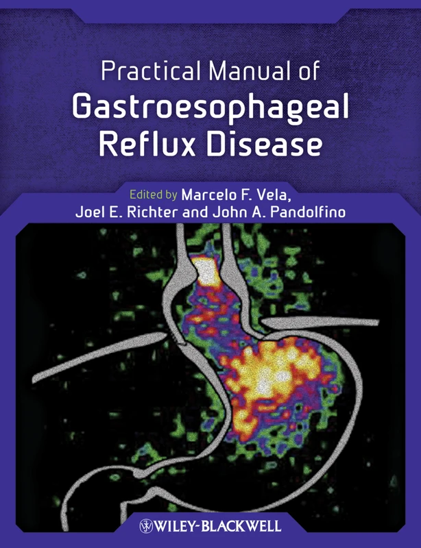 Practical Manual of Gastroesophageal Reflux Disease