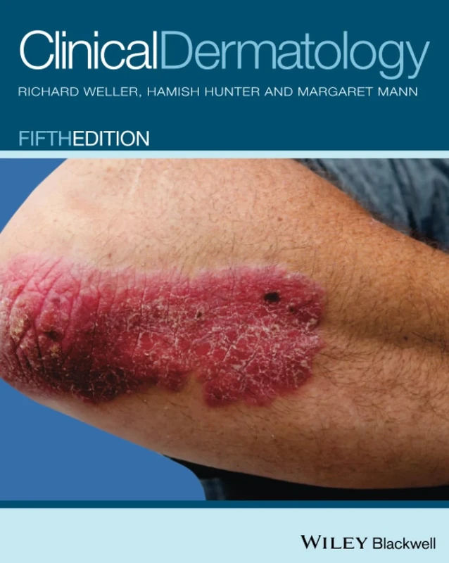 Clinical Dermatology