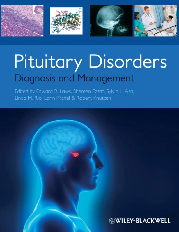 Pituitary Disorders: Diagnosis and Management