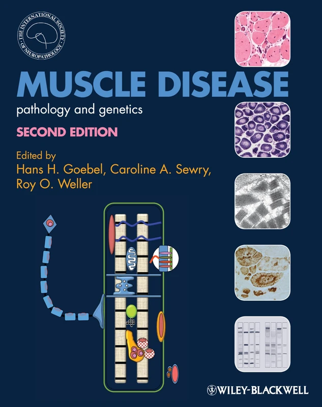 Muscle Disease: Pathology and Genetics (International Society of Neuropathology Series)