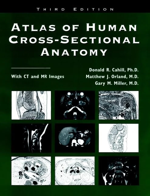 Atlas of Human Cross–Sectional Anatomy: With CT and MR Images