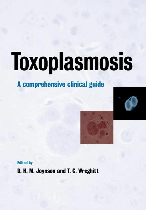 Toxoplasmosis: A Comprehensive Clinical Guide - Image 1