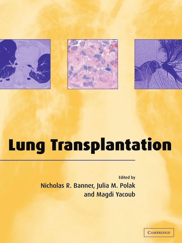 Lung Transplantation