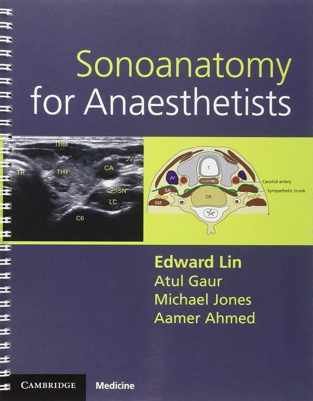 Sonoanatomy for Anaesthetists (Cambridge Medicine (Paperback))