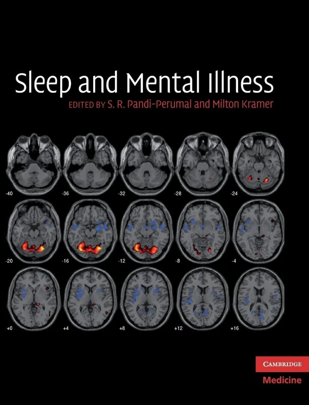 Sleep and Mental Illness (Cambridge Medicine (Hardcover))