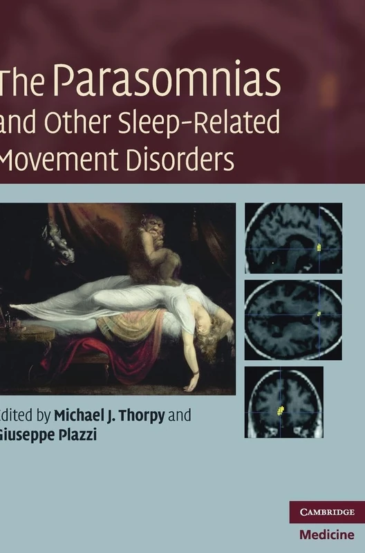 The Parasomnias and Other Sleep-Related Movement Disorders (Cambridge Medicine (Hardcover))