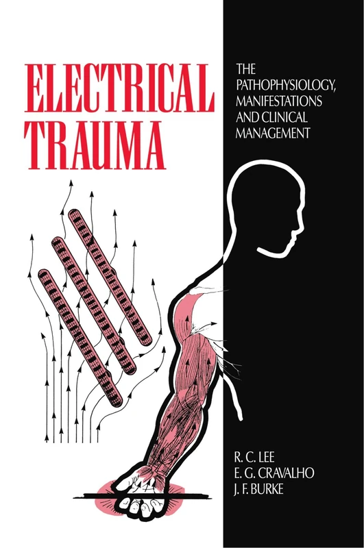 Electrical Trauma: The Pathophysiology, Manifestations and Clinical Management