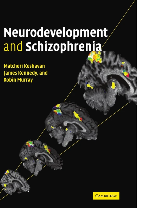 Neurodevelopment and Schizophrenia