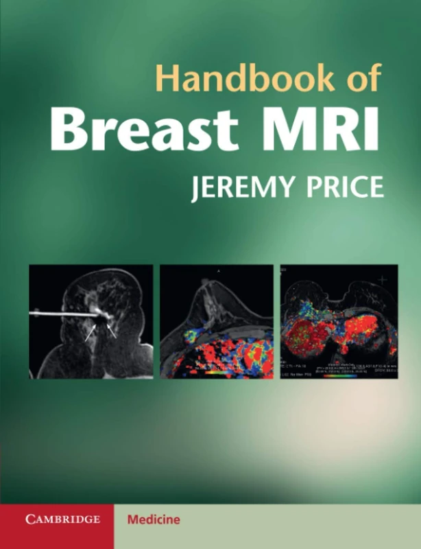 Handbook of Breast MRI (Cambridge Medicine (Paperback))