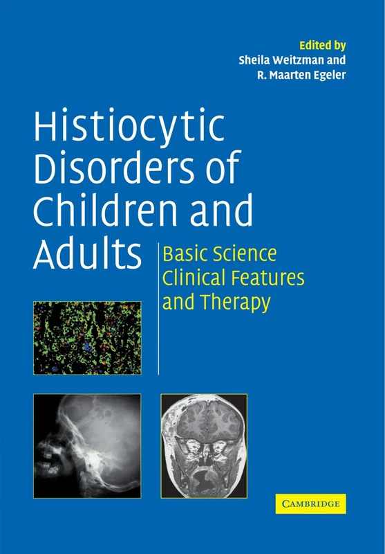 Histiocytic Disorders of Children and Adults: Basic Science, Clinical Features and Therapy