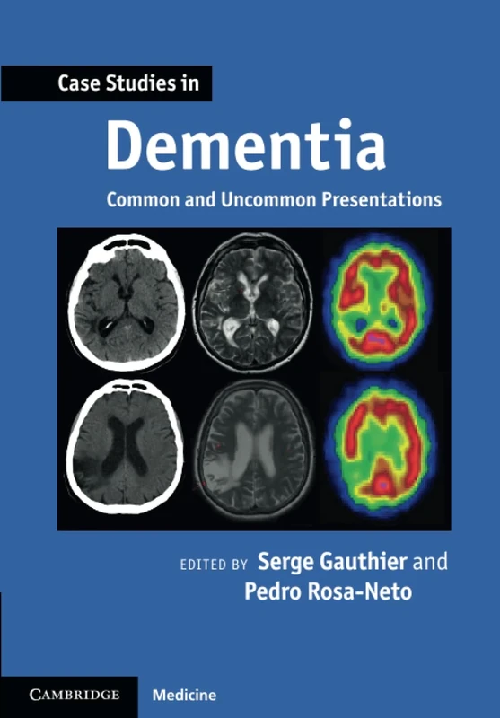 Case Studies in Dementia: Common And Uncommon Presentations (Case Studies in Neurology)