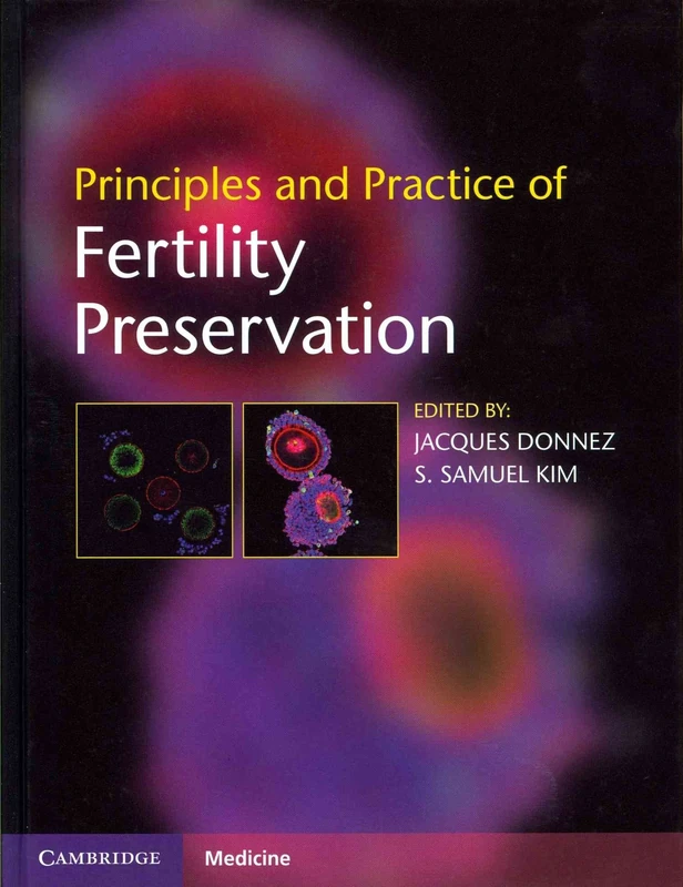 Principles and Practice of Fertility Preservation
