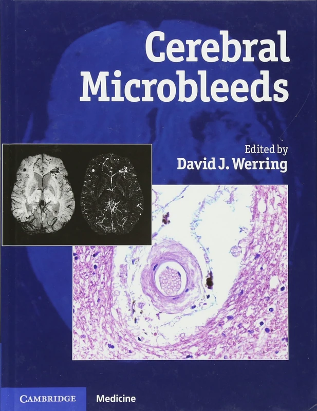 Cerebral Microbleeds: Pathophysiology to Clinical Practice (Cambridge Medicine (Hardcover))
