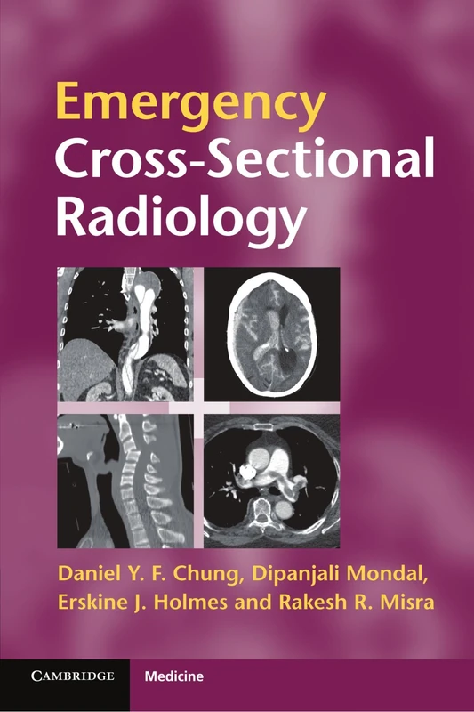 Emergency Cross-sectional Radiology (Cambridge Medicine (Paperback))