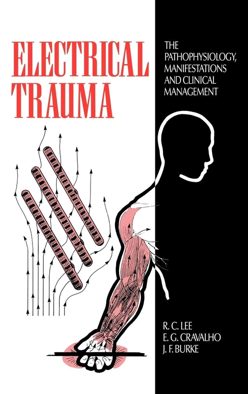 Electrical Trauma: The Pathophysiology, Manifestations and Clinical Management