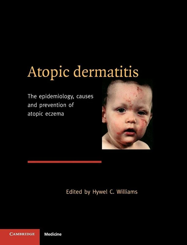 Atopic Dermatitis: The Epidemiology, Causes and Prevention of Atopic Eczema