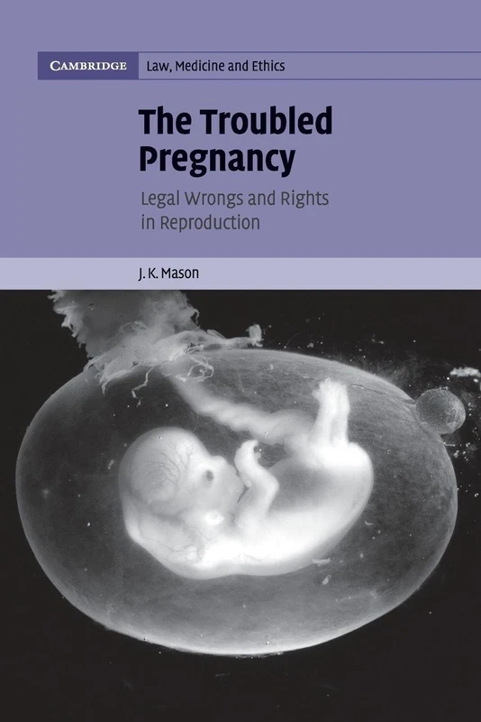 The Troubled Pregnancy: Legal Wrongs and Rights in Reproduction: Series Number 5 (Cambridge Law, Medicine and Ethics, Series Number 5)