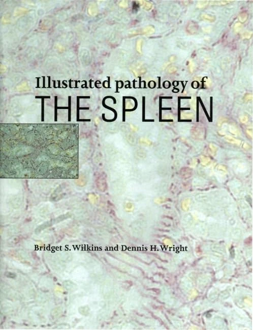 Cambridge University Press - Illustrated Pathology of the Spleen