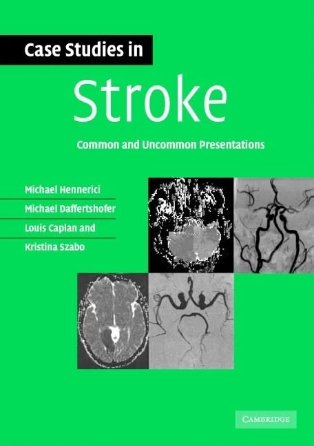 Case Studies in Stroke: Common and Uncommon Presentations (Case Studies in Neurology)