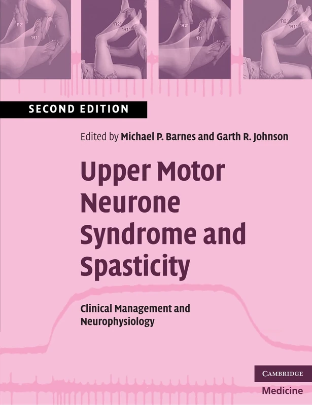 Upper Motor Neurone Syndrome and Spasticity: Clinical Management and Neurophysiology (Cambridge Medicine (Paperback))