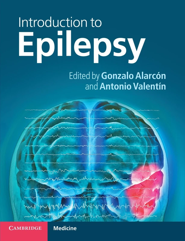 Introduction to Epilepsy (Cambridge Medicine (Paperback))