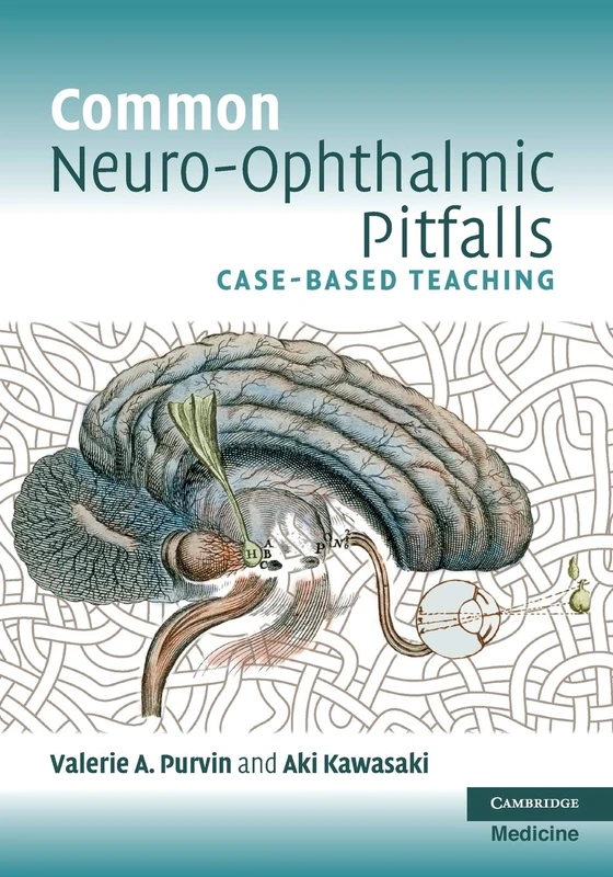 Common Neuro-Ophthalmic Pitfalls: Case-Based Teaching (Cambridge Medicine (Paperback))
