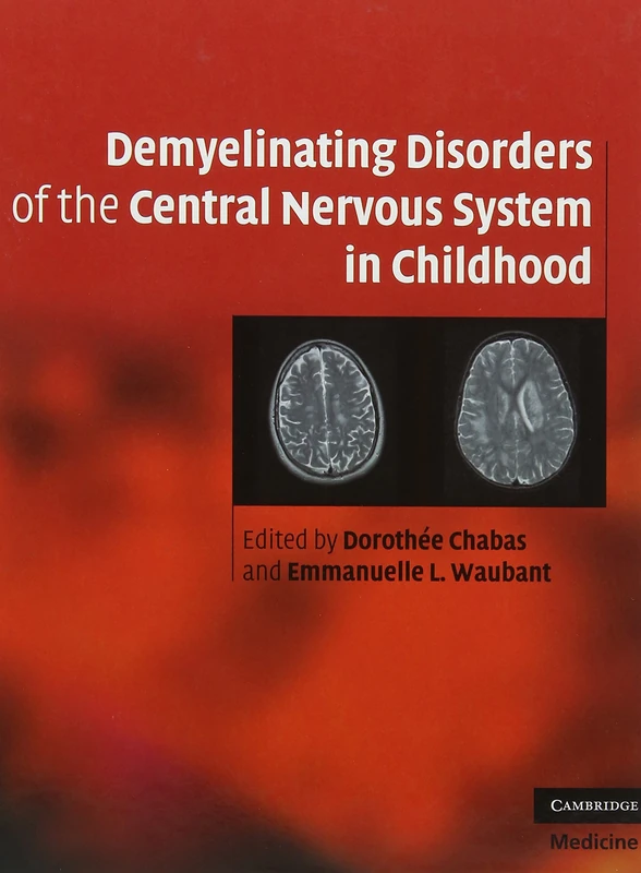 Demyelinating Disorders of the Central Nervous System in Childhood (Cambridge Medicine (Hardcover))