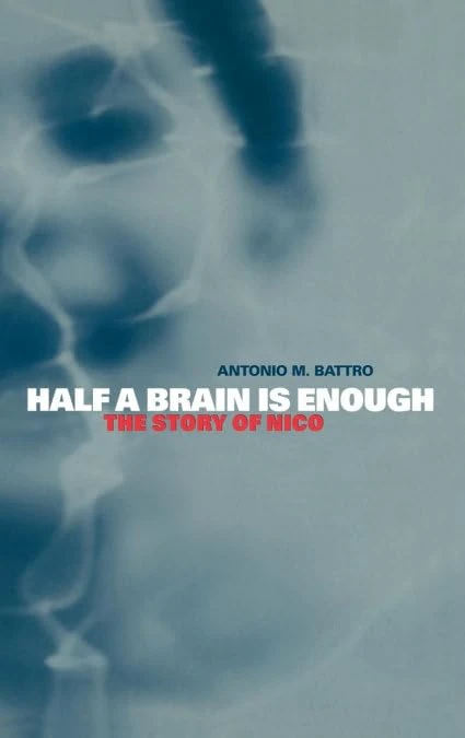 Half a Brain is Enough: The Story of Nico: 5 (Cambridge Studies in Cognitive and Perceptual Development, Series Number 5)