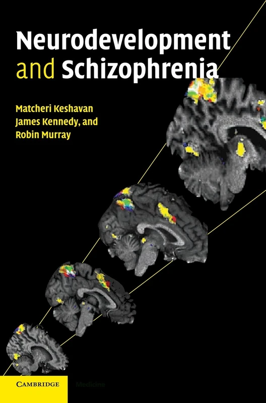 Neurodevelopment and Schizophrenia - Cambridge University Press